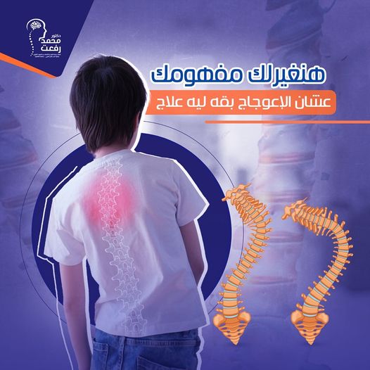 الإعوجاج